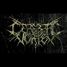 Cerebral Vortex